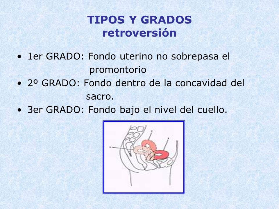 utero en retroversoflexion grado 2